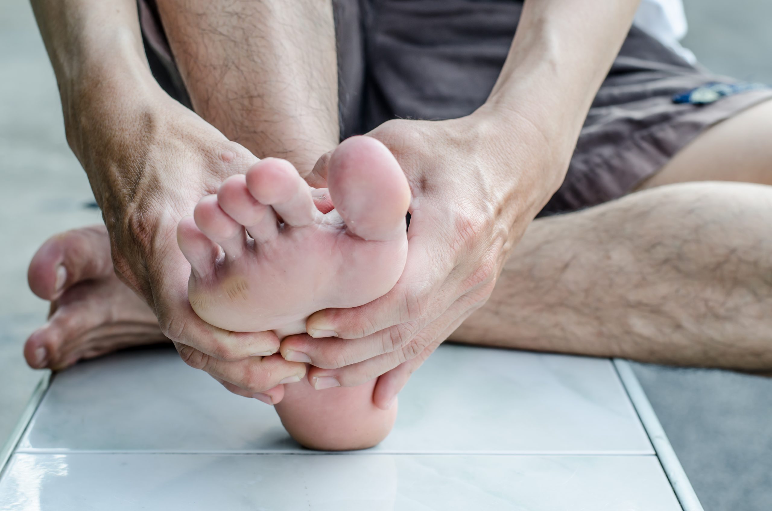 Remedial Massage treatment of foot pain and plantar facilitis 